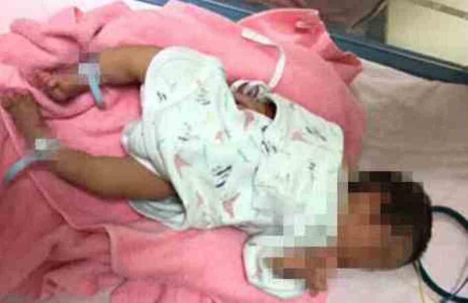 
▲在婦幼醫院遭扯斷手的男嬰。（圖／記者陳聖璋翻攝）
