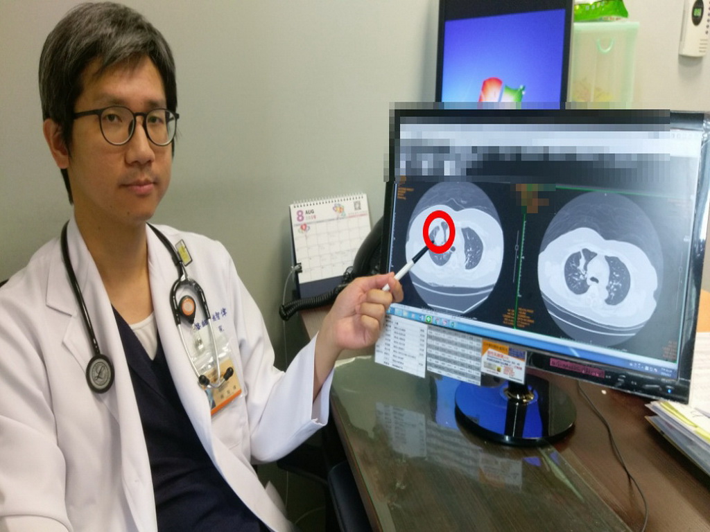 ▲醫生指著肺腺癌位置。 (圖／林重鎣攝2019.8.12)