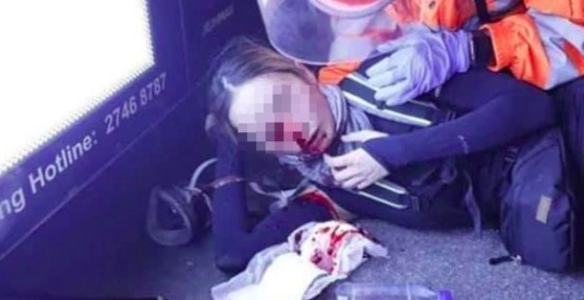 ▲11 日晚間港警與示威群眾發生流血衝突，一名女子遭子彈打中右眼。（圖／翻攝臉書）
