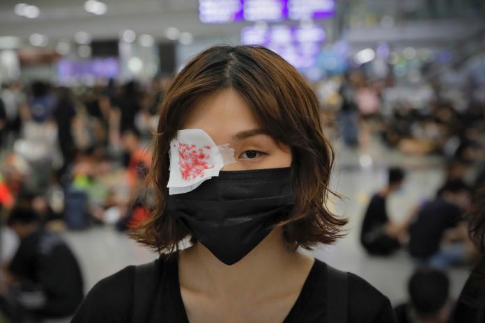 ▲香港警民衝突女子眼睛遭射爆，導致抗爭行動升級。（圖／美聯社／達志影像）