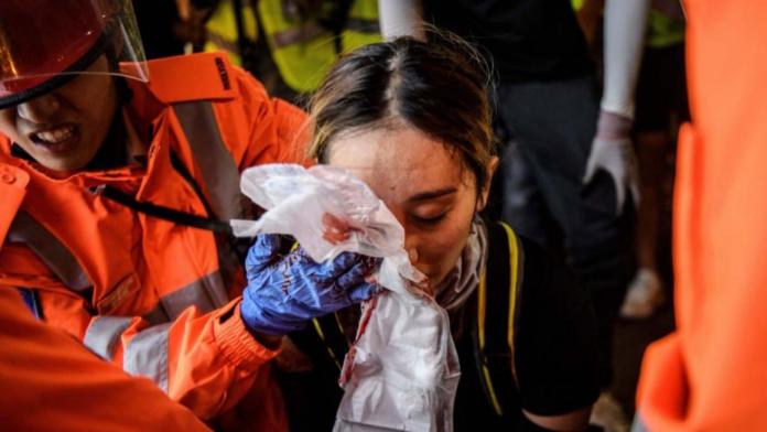 名家論壇》劉仕傑／當一名香港女子的眼睛被警察打瞎後

