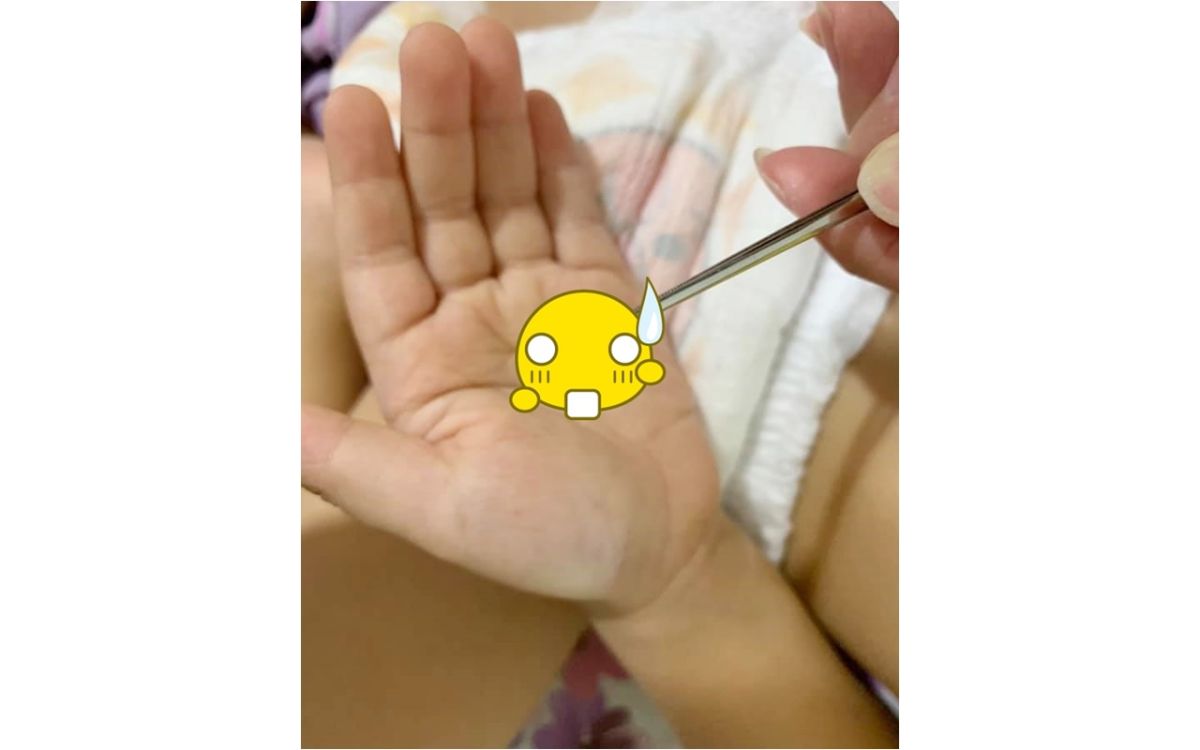 ▲一名媽媽在臉書上貼出一張照片，指出自己在 4 歲兒子的耳朵中挖出「超巨大耳屎」。（圖／翻攝爆廢公社）