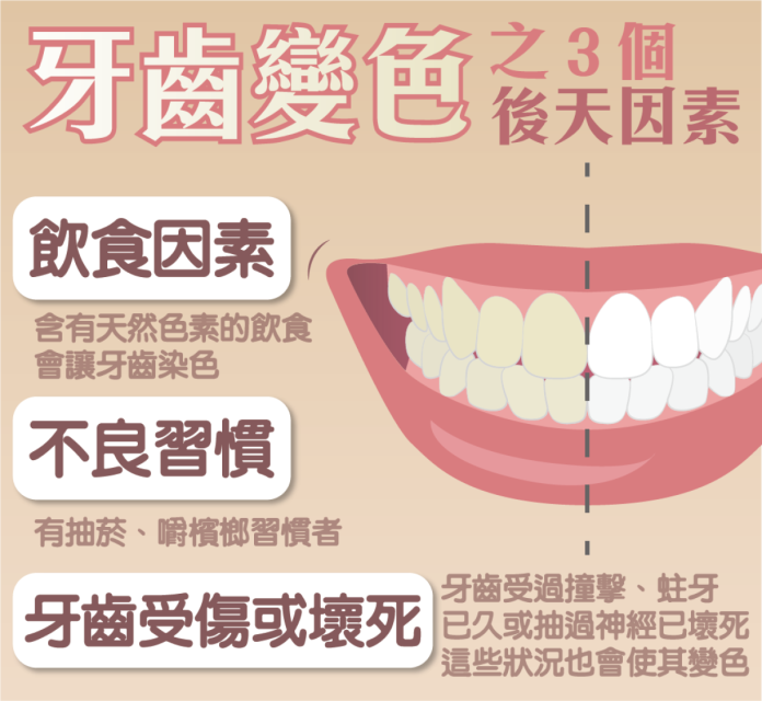 ▲牙齒變色有 3 類後天因素。（圖／取自食品藥物管理署網站）