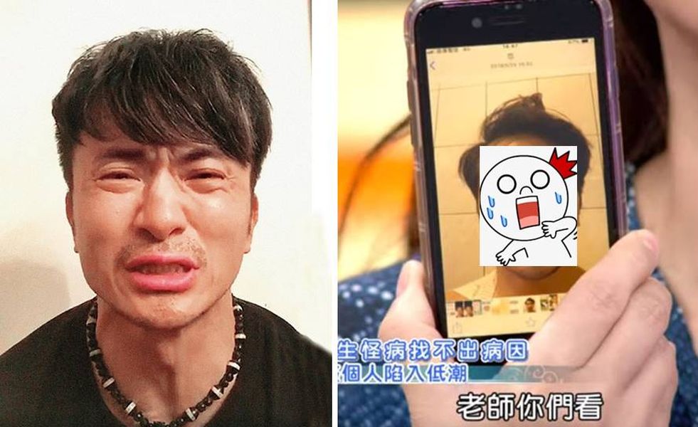 ▲唐從聖得「怪病」，臉腫成豬頭。（圖／翻攝唐從聖臉書）
