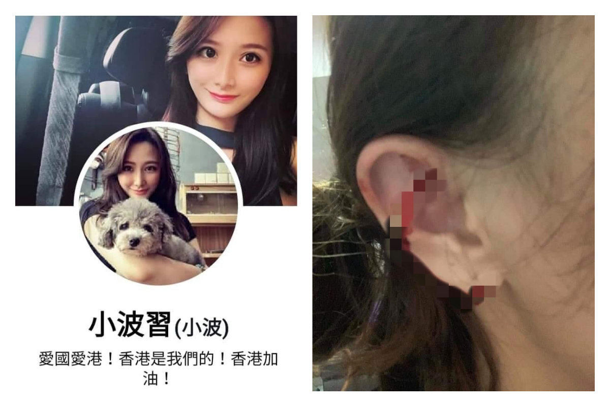 ▲網路上卻有一名貌美如花的女網友，在網路上發文表示自己「力挺香港警察，結果卻被港警毆打」。（圖／翻攝自《爆料公社香港、澳門版》）