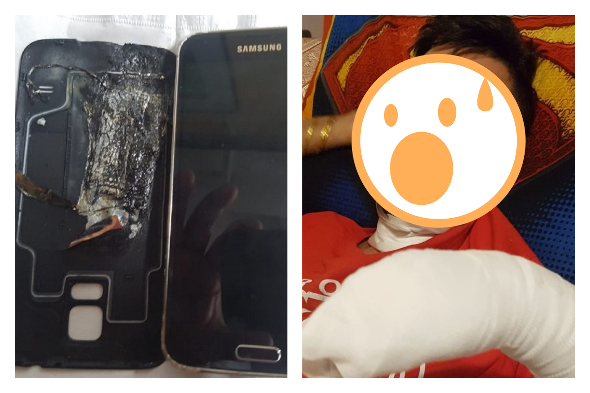 ▲加拿大一名男子，因為自己的三星 S5 手機突然爆炸，臉及手部慘遭燒傷。（合成圖／翻攝自 City News ）