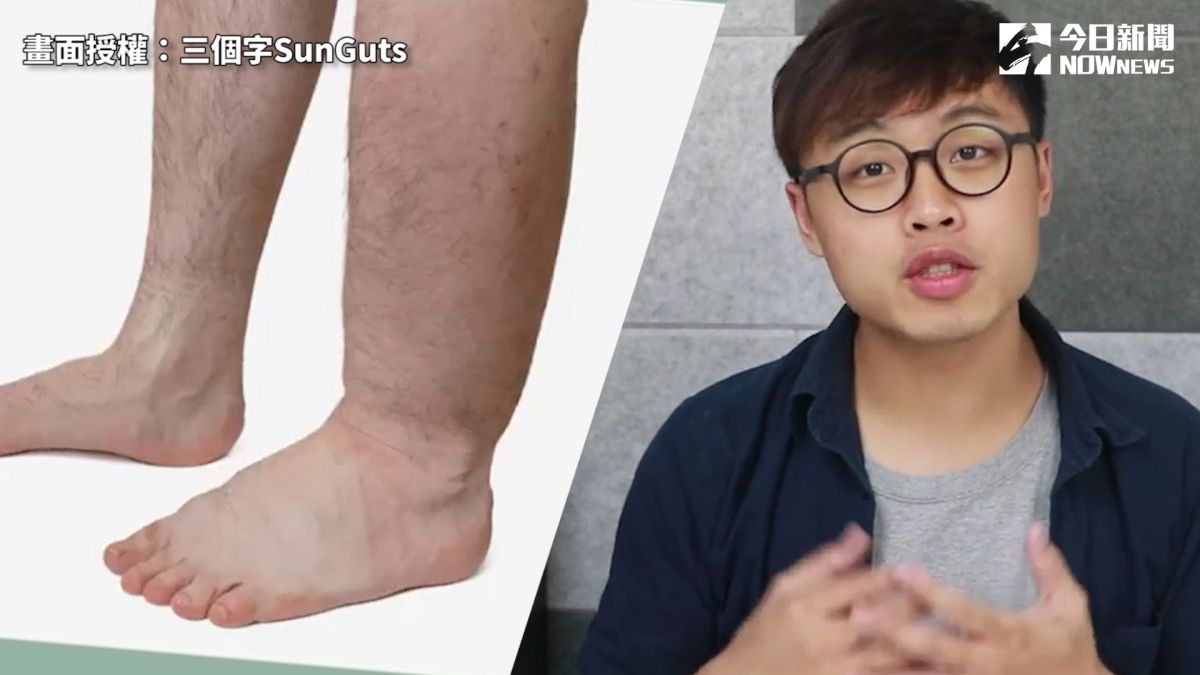 ▲ 軟底鞋其實很傷腳？物治師曝三大副作用。（圖／三個字 Sunguts 授權）