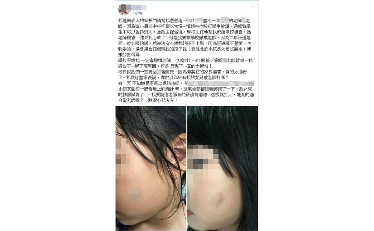 ▲小女童媽媽貼出女兒臉頰瘀青照表示，自己女兒遭到導師毆打成傷，想要學校撤換老師又遭到校長拒絕。（圖／翻攝「【我是南崁人】我愛南崁」）