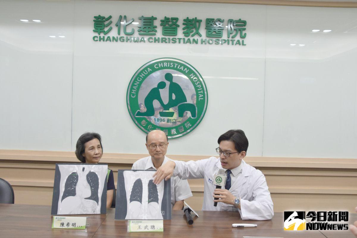 ▲王秉彥（右）指出，像王牧師夫婦就是定期檢查發現病灶的最佳例子。（圖／記者陳雅芳攝，2019.08.29）