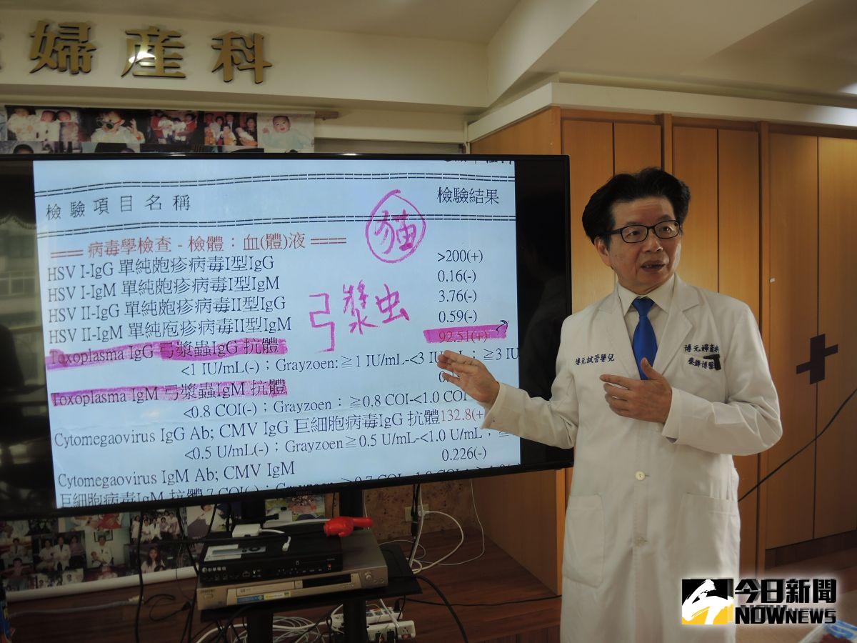 ▲疾管局證實孕婦若感染弓漿蟲確實會引起胎兒的問題。（圖／記者陳雅芳攝，2019.09.01）