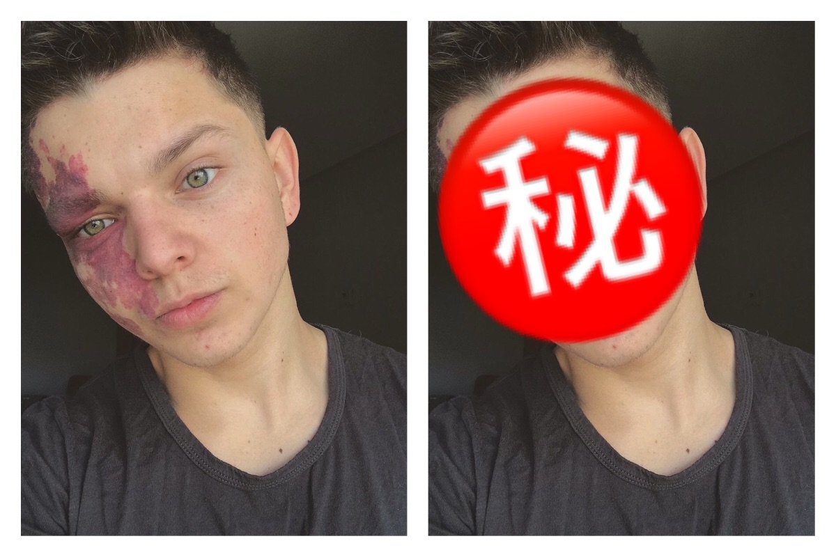 ▲現代人拍照都會常常修圖，不但要有良好的修圖軟體，更要會修圖技術，而修圖不單單只是為了好看，或許還能夠遮瑕。（圖／翻攝自推特）