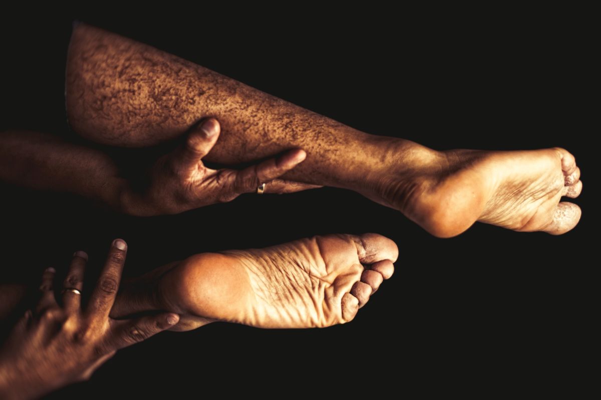 ▲男子為了不願動手術強忍跛腳 20 年。（示意圖／圖中非當事人，取自 Unsplash ）