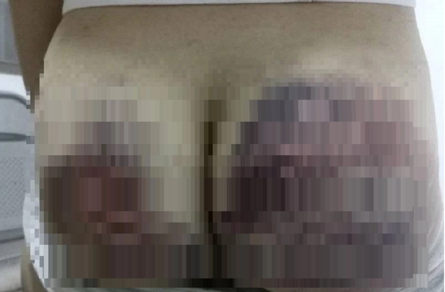 ▲林婦創立的教派要求信徒互毆以驅魔，對2歲幼童毆打也不手軟。（圖／警方提供）