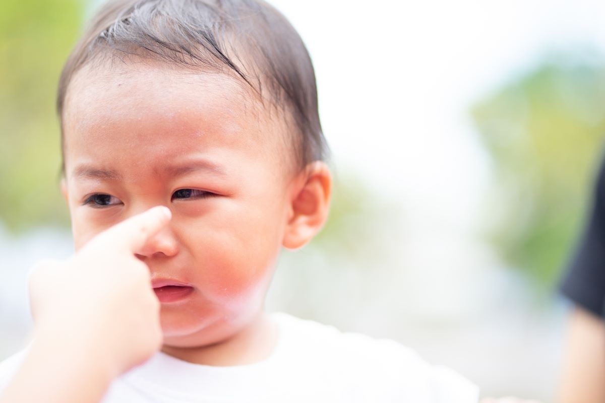 ▲過敏若表現在眼睛部分，像過敏性結膜炎，或是紅眼、發癢，出現灼熱感及黑眼圈等，都是常見症狀。（圖／資料照片）