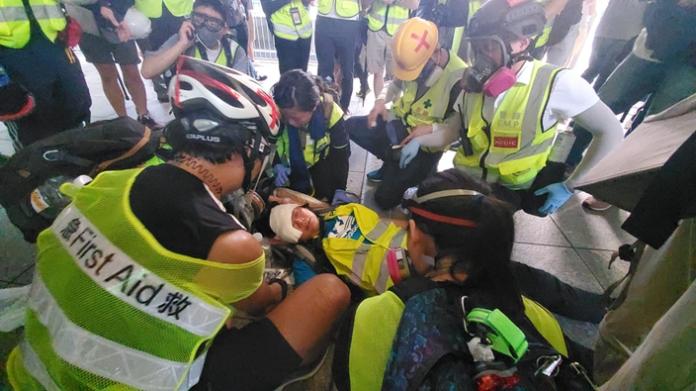 ▲ 1 名印尼女記者在 29 日的香港示威採訪時，疑遭港警以布袋彈打中右眼，受傷送醫。（圖／翻攝自巴士的報）
