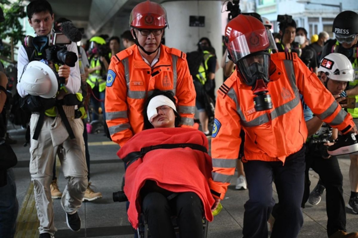 ▲香港反送中示威 9 月 29 日再爆發大規模衝突。有印尼記者遭港警發出的橡膠子彈打中眼睛送醫，確定永久失明。（圖／翻攝自巴士的報）