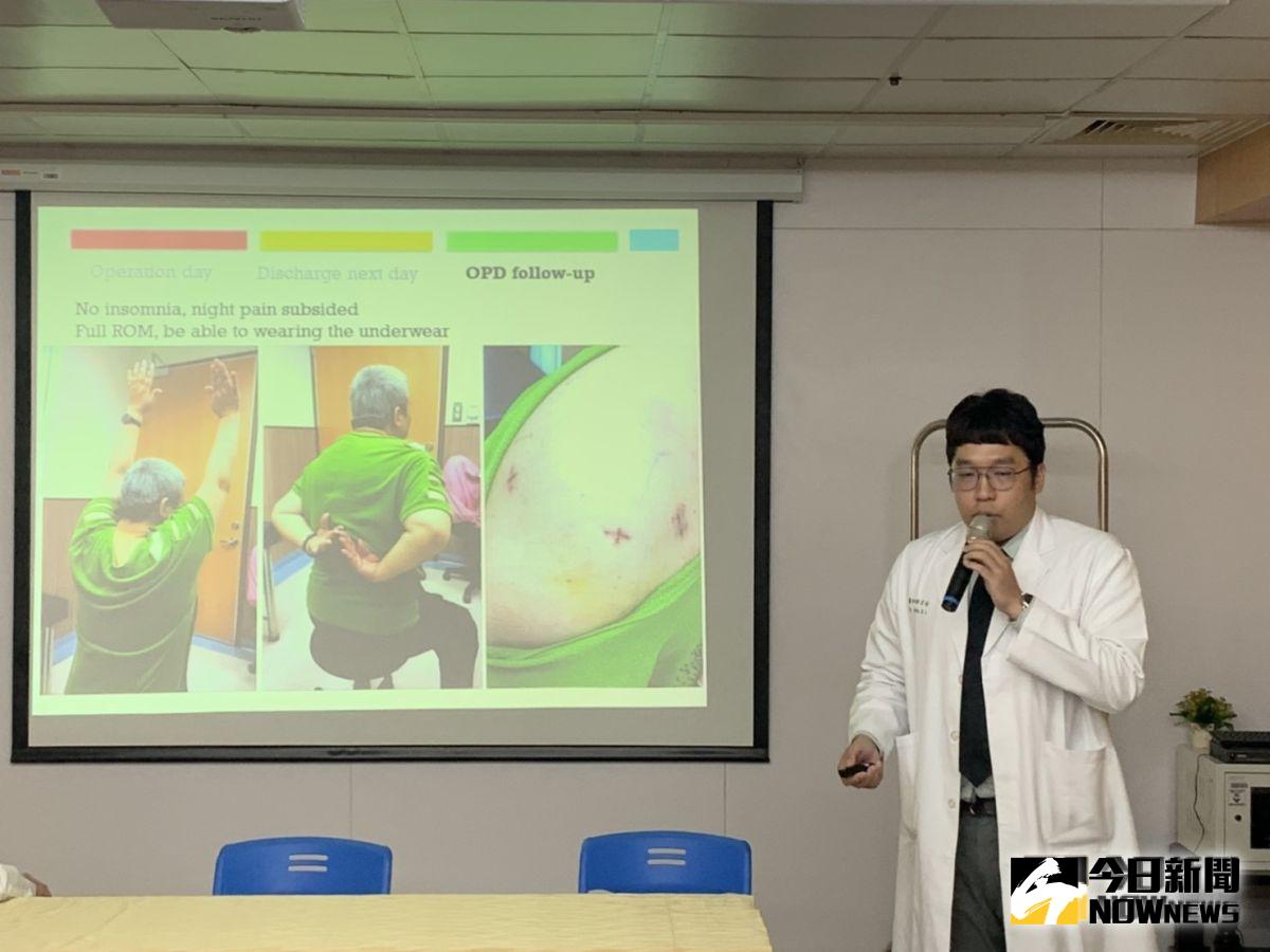 ▲微創手術。（圖／記者洪佳伶，2019.10.01）