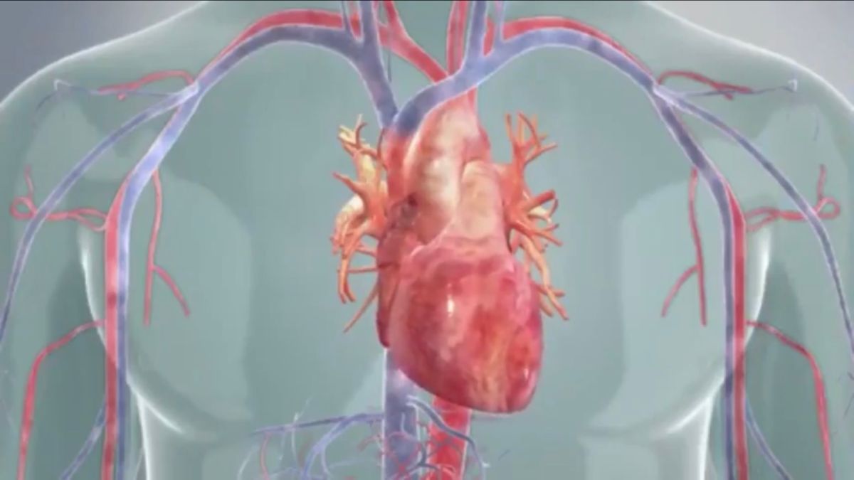 ▲主動脈瓣狹窄病人有增加趨勢。超過75歲的老年人，約 12%的人有主動脈瓣膜狹窄的問題。（圖／台北榮總提供）