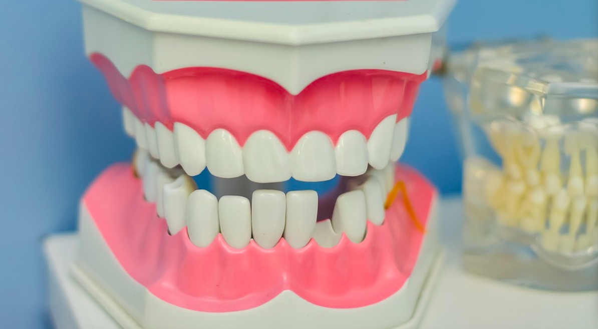 ▲牙齒若沒照顧好，一但掉下來錢包麻煩就大了。（示意圖／取自pixabay）