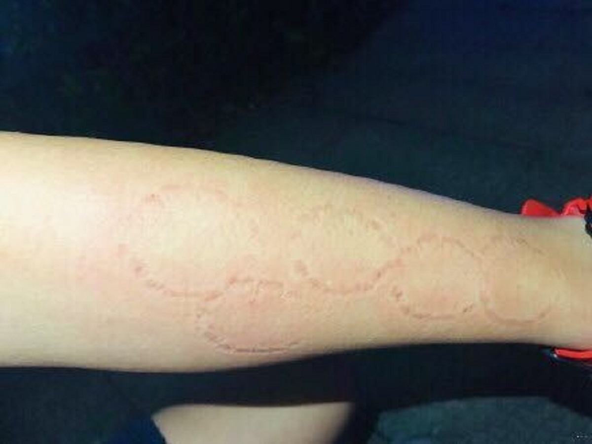 ▲一名人妻帶著牙齒印及鞭痕返家，丈夫氣炸了。（示意圖，非當事人／翻攝自百度貼吧）