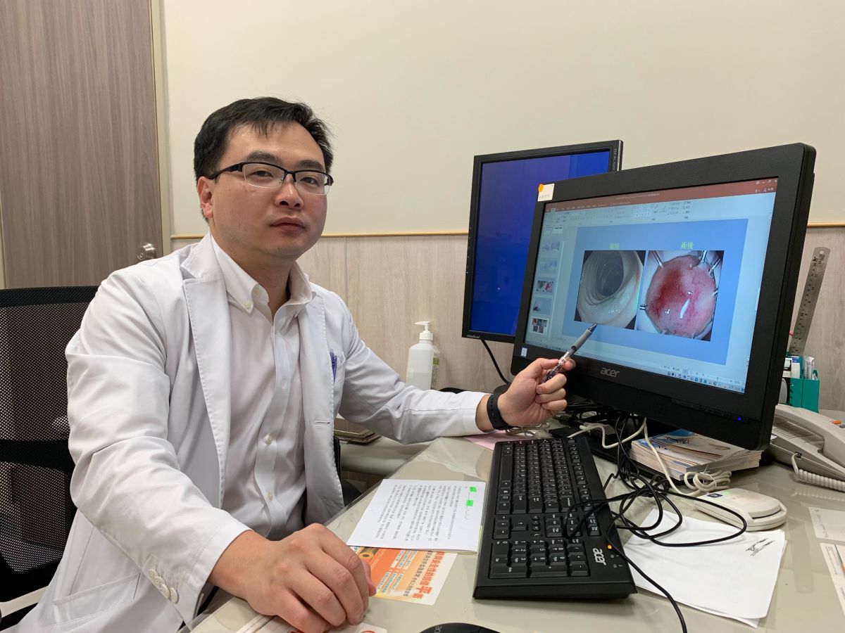 ▲消化科醫師范峻維利用「內視鏡粘膜下切除術」完整切除可能癌化的惡性瘜肉。（圖／中醫大新竹附醫提供）