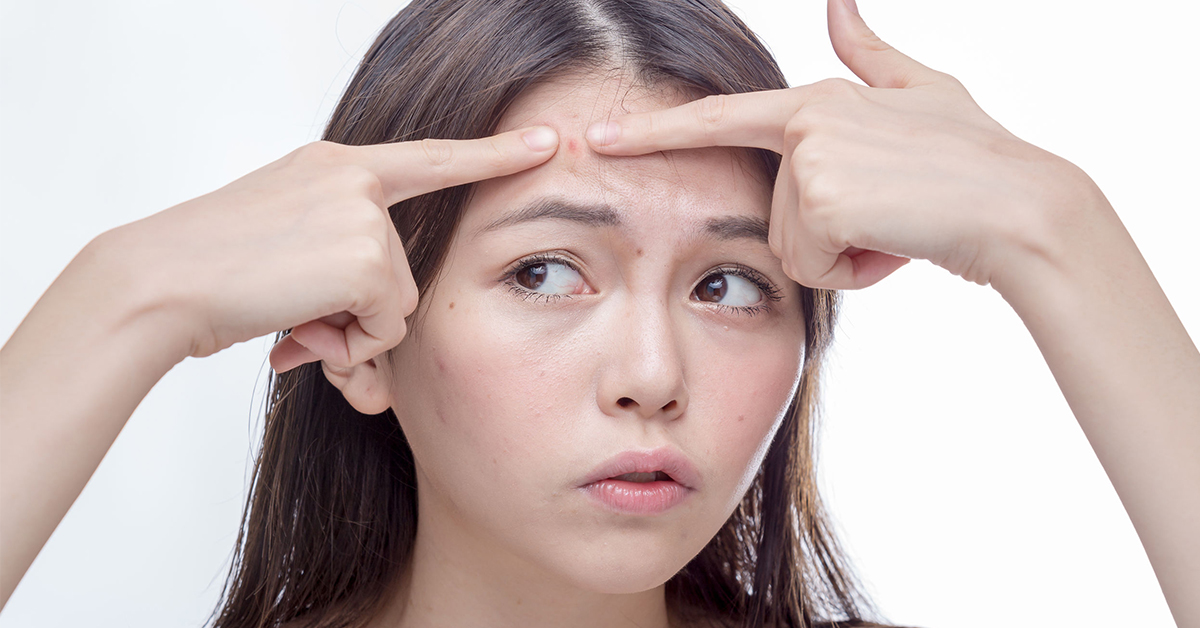 ▲外在空氣汙染、生活作息不正常、過度化妝或不當清潔，常成為現代人痘痘生成的原因，長久下來反覆發炎忽略處理，恐形成難以治療的凹陷型痘疤。（圖／123RF圖庫）