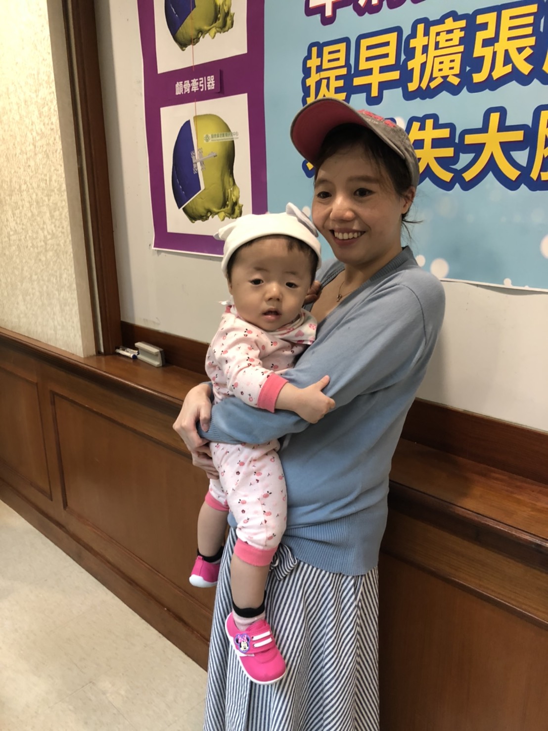 ▲吳小妹頭型和一般寶寶不太一樣，眉骨比較凹陷，頭顱也寬扁，經醫生確診為罹患了罕見的「多條顱縫早閉症」。（圖／記者劉雅文拍攝）