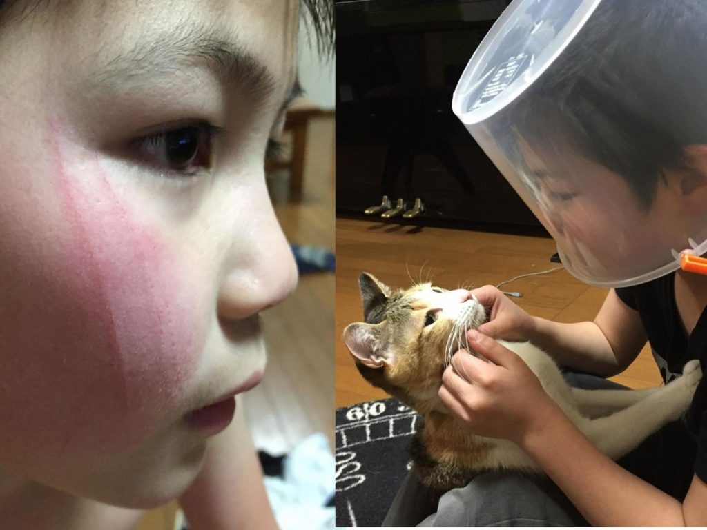 小貓奴被主子抓傷後，自製防抓面罩繼續撸貓！（圖／FB@Hospital Memorial São José）