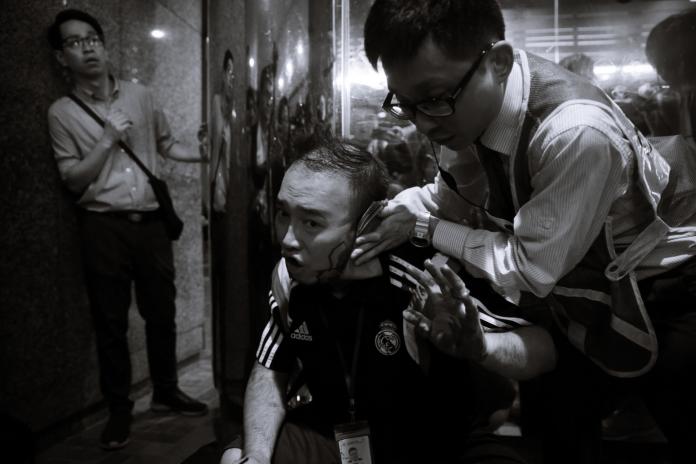 ▲香港太古城西區議員趙家賢趙家賢在混亂中左耳被咬掉。（圖／翻攝香港01）