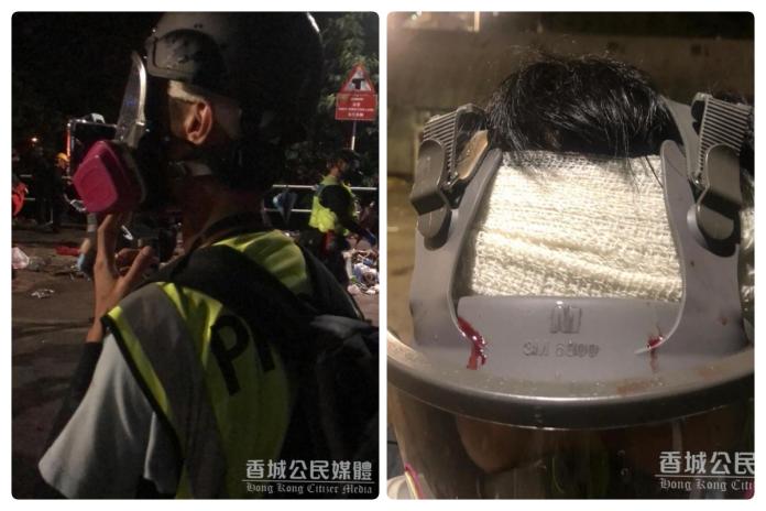 ▲一名香港記者在中文大學現場採訪時，遭警方連射多枚橡膠子彈，頭部中彈受傷。（圖／翻攝《香城公民媒體》）