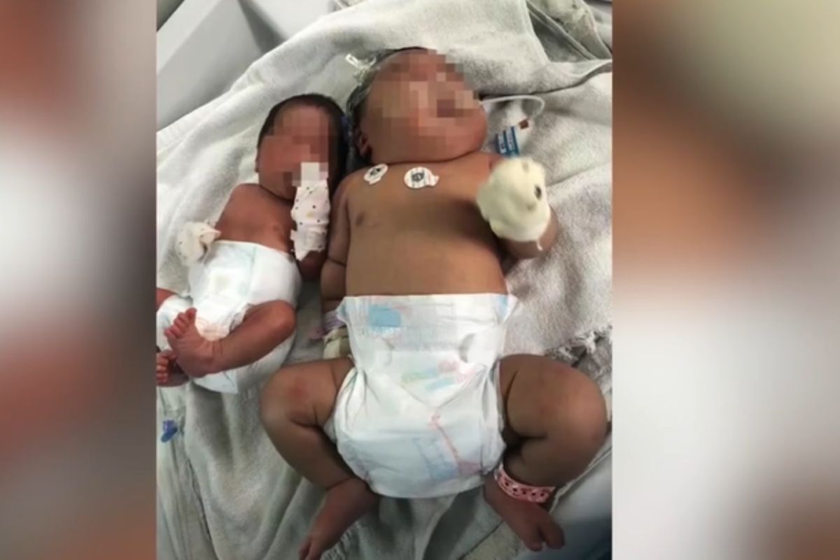 ▲女嬰個頭幾乎是一般新生兒的 2 倍大。（圖／翻攝自網路）