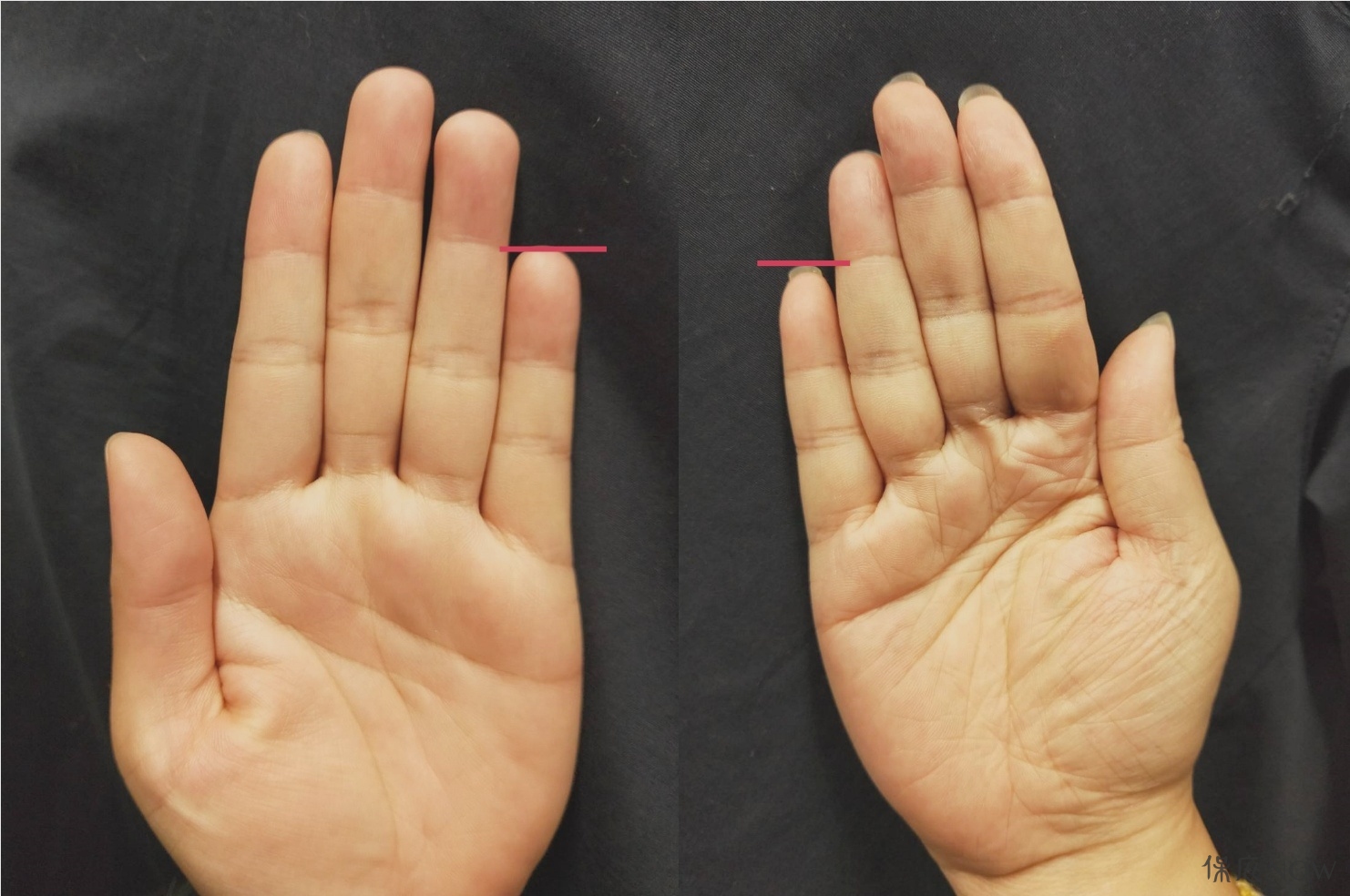 若小拇指長度有到無名指第一個指節，就不需留指甲補運；若長度不及就可將指甲留長補運。（圖／保庇NOW資料圖）
