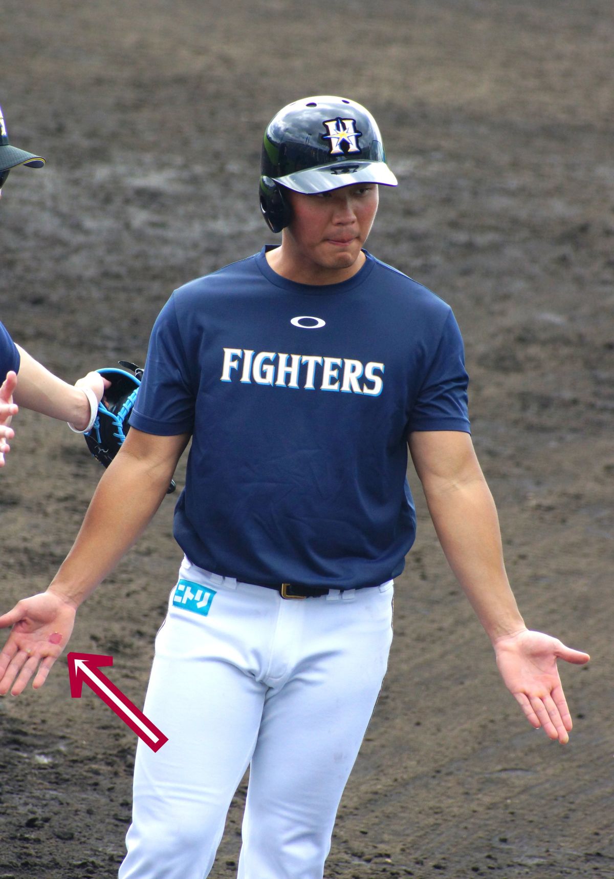 王柏融手掌練到破皮。（圖／取自網路）