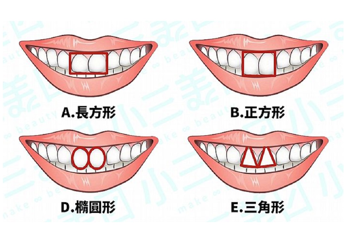 ▲超準國外爆紅測驗！從「門牙形狀」看出你的隱藏性格。（圖／翻攝自美日誌）