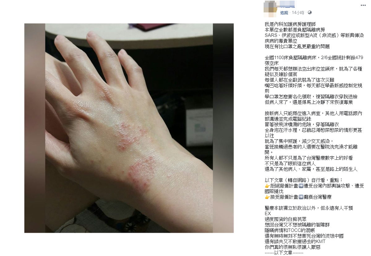 隔離病房護理師曬手傷照！曝眼下台灣防疫「最嚴重危機」 | 生活 | NOWnews今日新聞