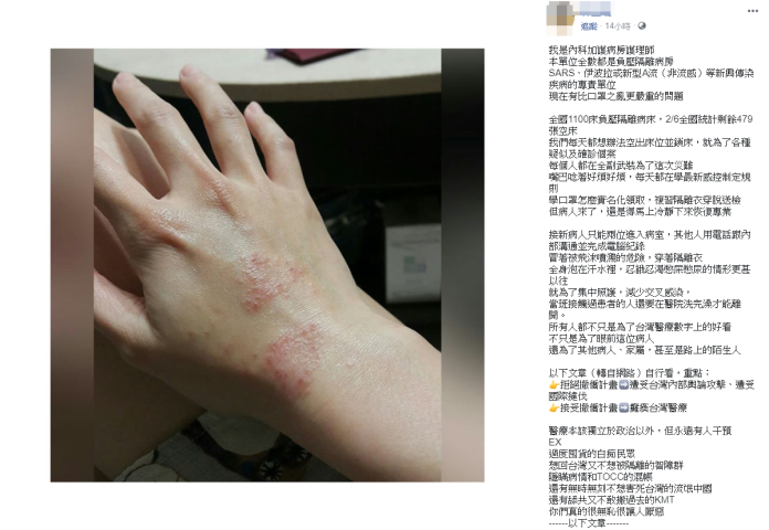 隔離病房護理師曬手傷照！曝眼下台灣防疫「最嚴重危機」
