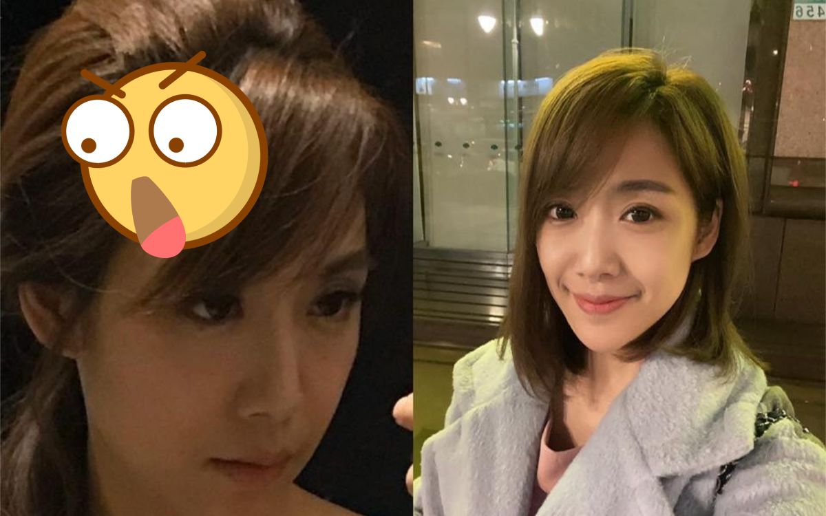 ▲藝人依依自爆禿頭危機。（圖／翻攝臉書） 