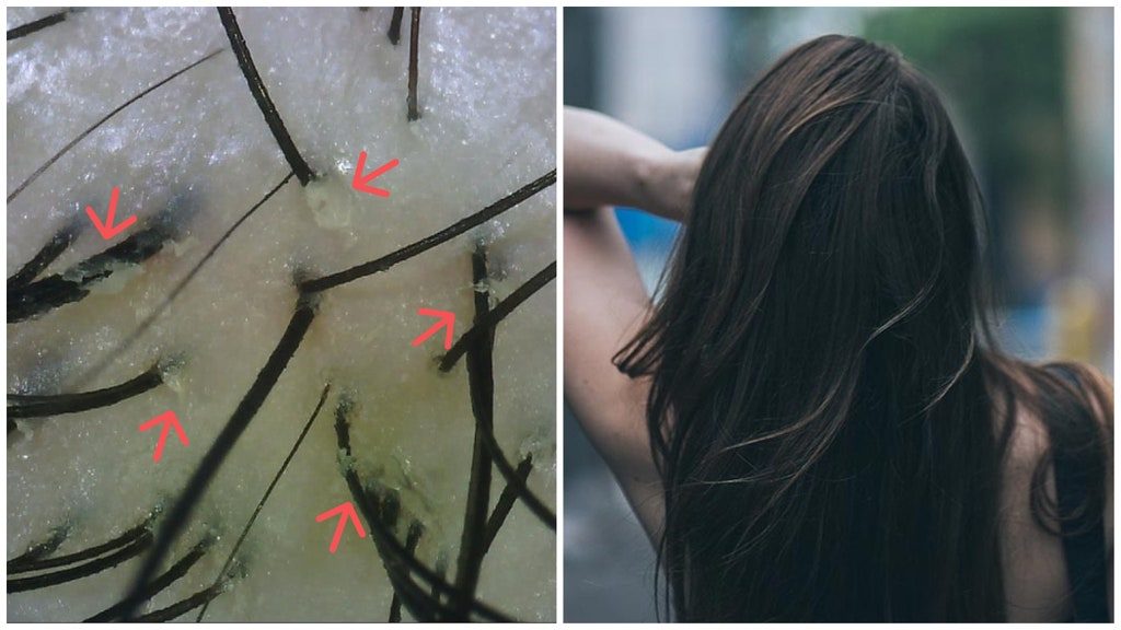 ▲頭皮問題都是來自「頭皮清潔不正確」。（圖／VOGUE提供）