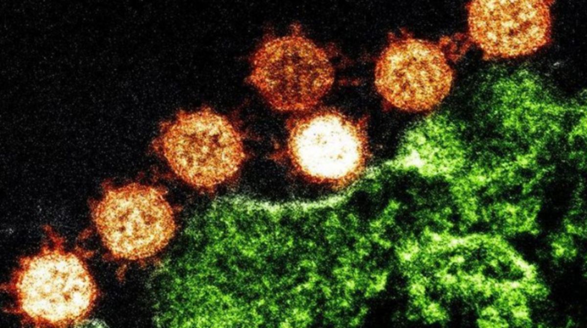 ▲ 2019 新型冠狀病毒。（圖／翻攝自澳洲 9 News）