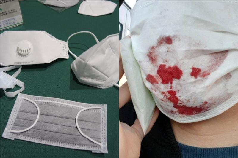 ▲一名南韓網友指出，自己搭火車時因口罩突染血，而遭到隔離。（圖／ NOWnews 資料庫、翻攝 quasarzone ）