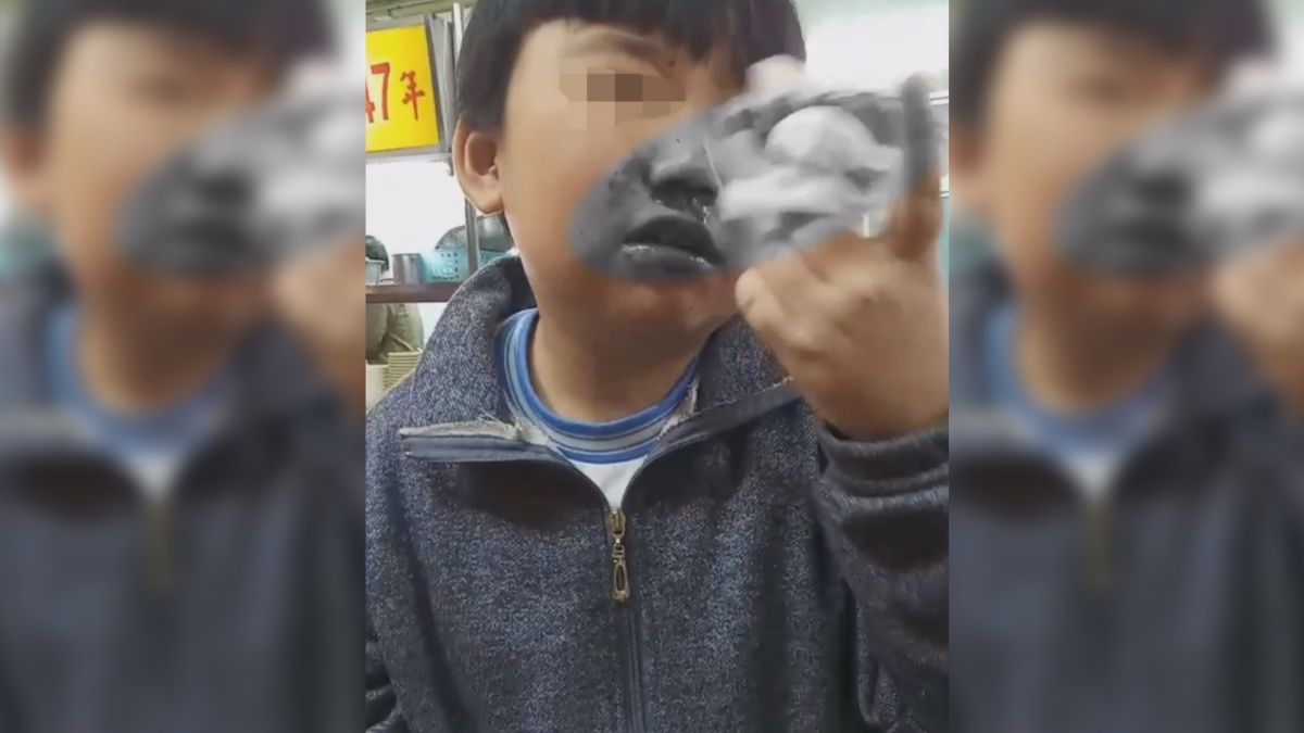 ▲台北市某國小一名學童，日前疑似遭到導師摑巴掌至流鼻血，校方辯稱是擔心飛沫噴濺，老師有輕觸到學童嘴巴。（圖／台北市議員王欣儀辦公室提供）