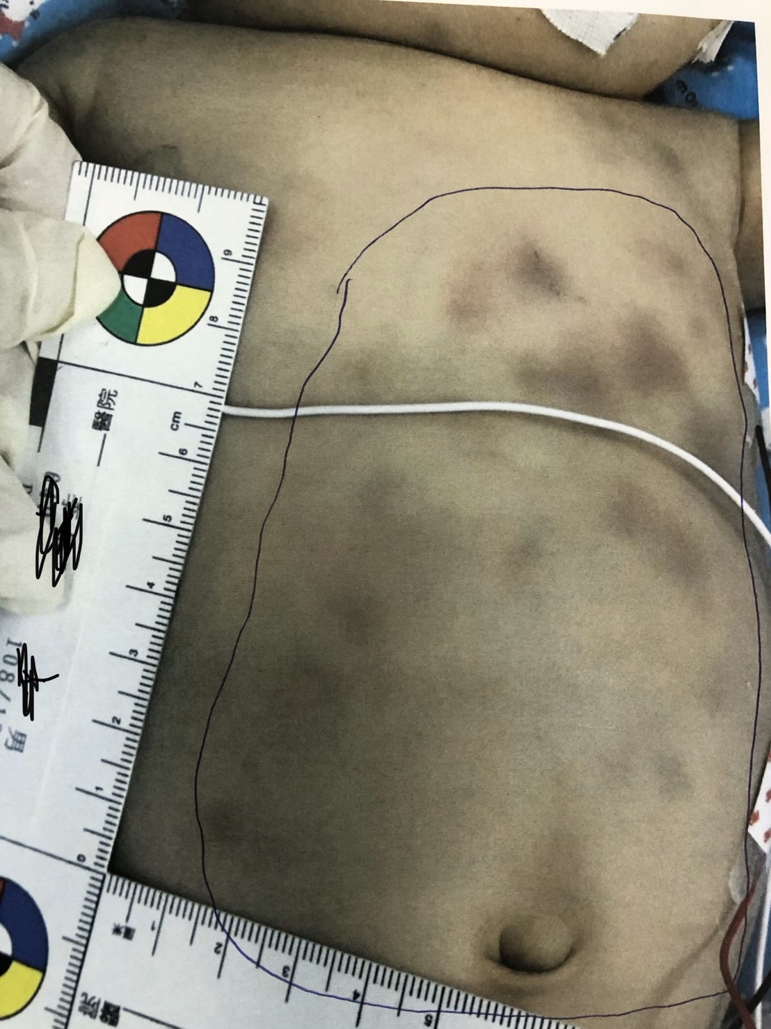 ▲1月大男嬰遭其生父痛毆險喪命，法官只判3年的理由是生父願「極力彌補」。（圖／記者陳聖璋翻攝）