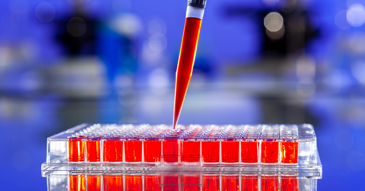 ▲有許多研究單位針對2019新型冠狀病毒COVID-19找尋疫苗與治療藥物，希望能幫助全球對抗這波疫情，其他也有希望藉由自體免疫細胞，讓它成為對抗病毒的方式。（圖／ingimage）