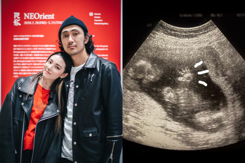 ▲歐陽靖宣布懷孕五個月。（圖／取自歐陽靖臉書）