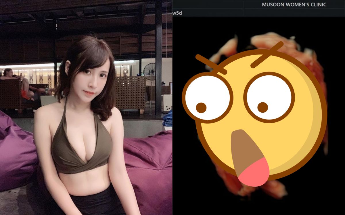 ▲潔哥曬出小孩超音波照。（圖／翻攝潔哥臉書） 