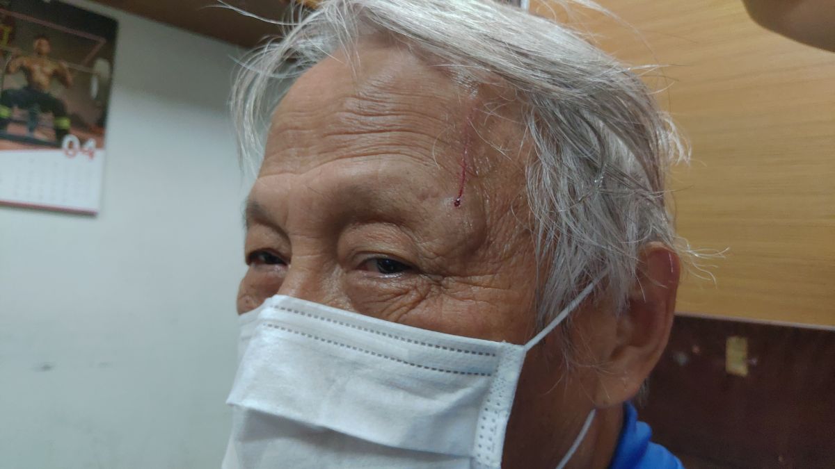 ▲台中區農業改良場傳出鳳頭蒼鷹傷人的意外，凌姓老伯左眼角也遭利爪抓傷。（凌姓民眾提供 圖／記者陳雅芳攝，2020.04.25）