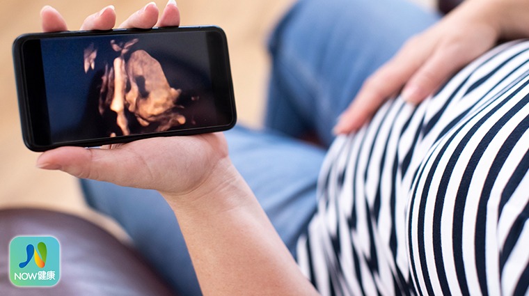 孕婦曝露在電磁波環境 恐增加孩子日後過動症風險