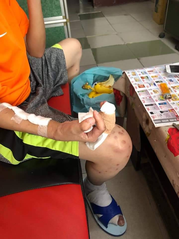 ▲羅姓少年打工慘遭惡老闆詹男囚虐達3個月，全身被BB彈打得皮開肉綻。（圖／記者陳雅芳攝，2020.05.06）