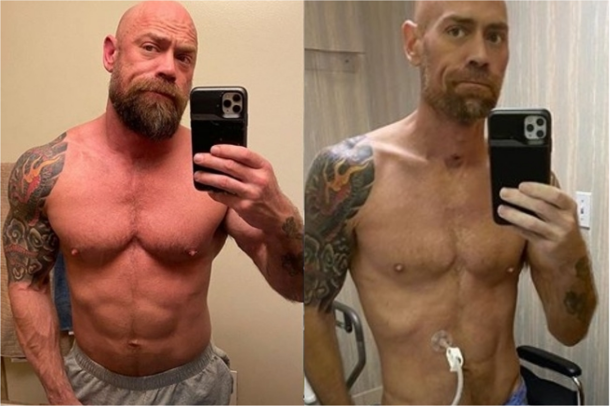 ▲美國舊金山護理師染疫後暴瘦，對比照片引發譁然。（合成圖／翻攝thebearded_nurs IG）