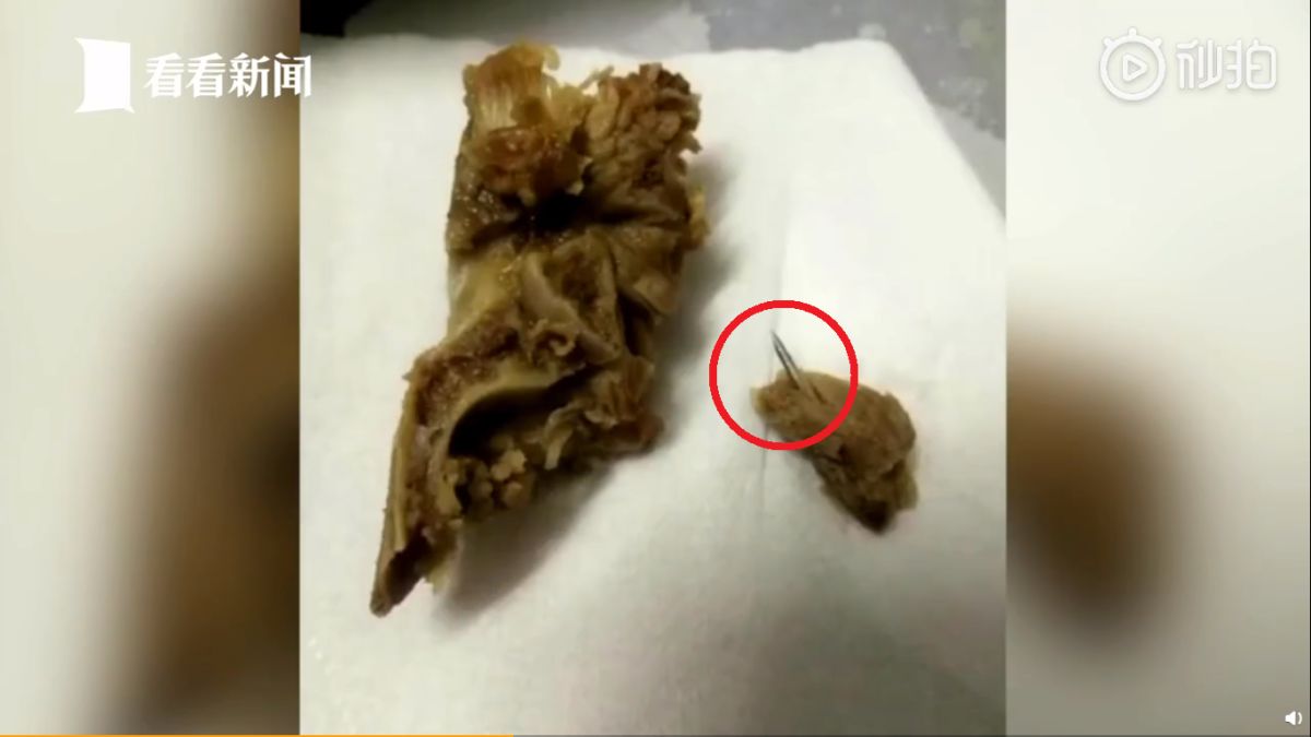 ▲中國大陸廣東省廣州一名男子發現買來的豬骨內有針頭。（圖／翻攝看看新聞微博）